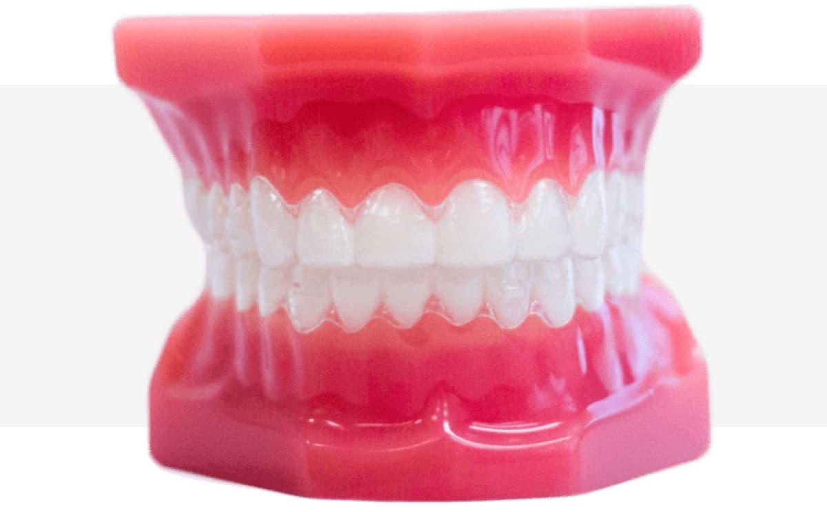 invisalign aligners model