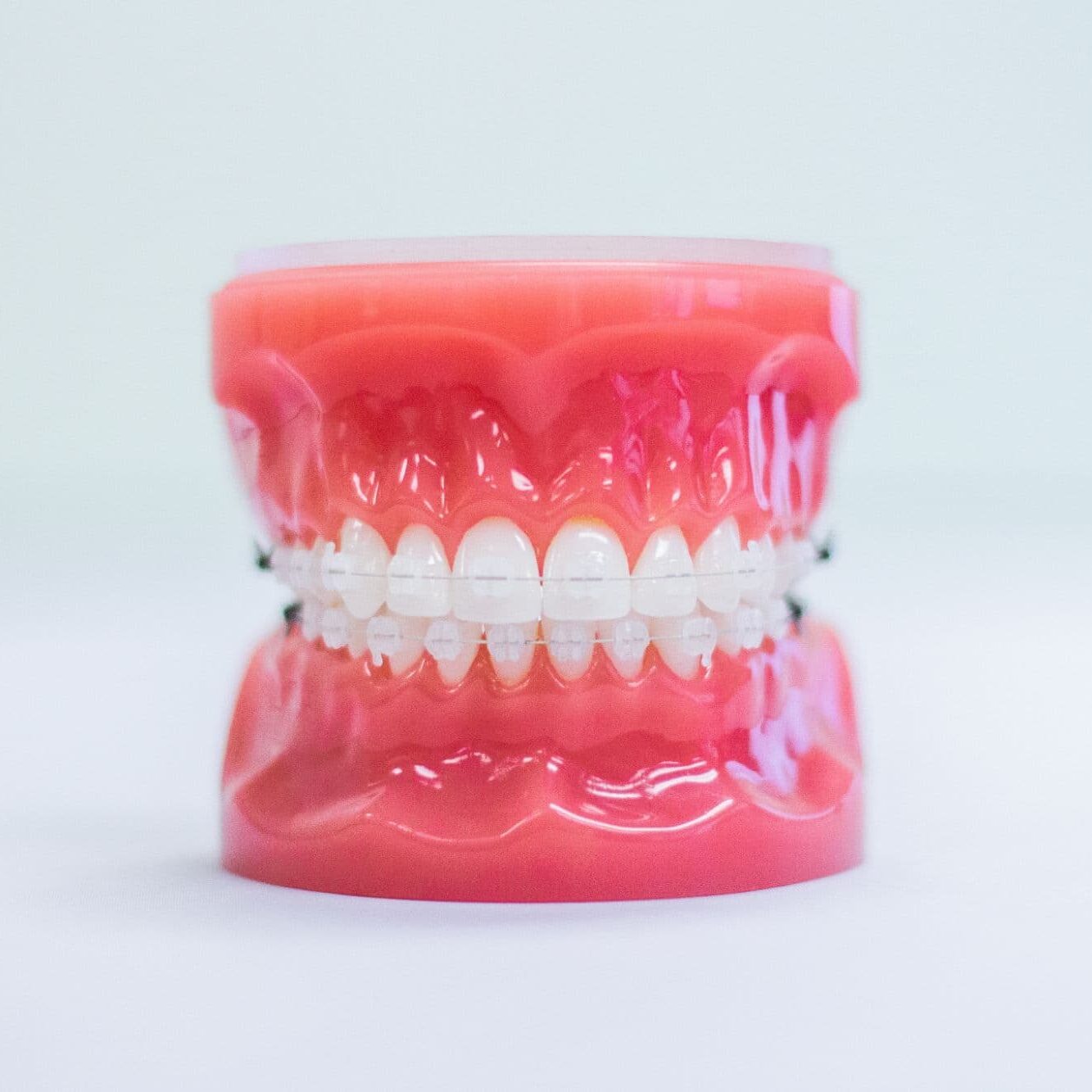 Novi clear braces